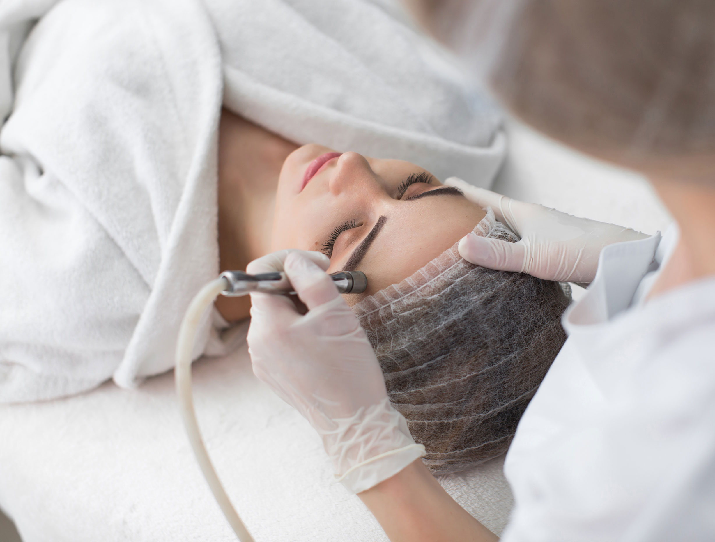 Microdermabrasion Skin Deep Cosmetic Clinic